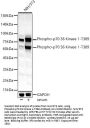 P70S6K1 (pT389) Antibody