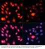 P70S6K1 (pT389) Antibody