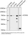 Potassium Intermediate Small Conductance Calcium Activated Channel Subfamily N, Member 1 (KCNN1) Antibody