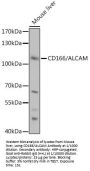 Activated Leukocyte Cell Adhesion Molecule / CD166 (ALCAM) Antibody