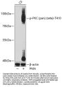 PKC (pan) (zeta) (pT410) Antibody