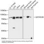 Transcriptional Repressor P66-Beta (GATAD2B) Antibody