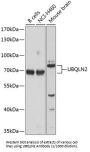 Ubiquilin-2 (UBQLN2) Antibody