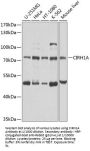 U3 Small Nucleolar RNA-Associated Protein 4 Homolog (CIRH1A) Antibody