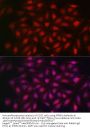 Importin Subunit Beta-1 (KPNB1) Antibody
