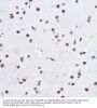 U4/U6.U5 Tri-SnRNP-Associated Protein 1 (SART1) Antibody