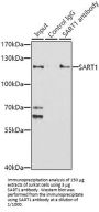 U4/U6.U5 Tri-SnRNP-Associated Protein 1 (SART1) Antibody
