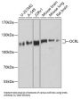 OCRL, Inositol Polyphosphate-5-Phosphatase (OCRL) Antibody