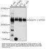 Chromosome Segregation 1 Like (CSE1L) Antibody