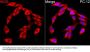 Nitric Oxide Synthase, Inducible (NOS2) Antibody