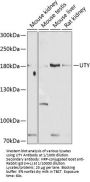 Ubiquitously Transcribed Tetratricopeptide Repeat Containing, Y-Linked (UTY) Antibody