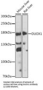 Dual Oxidase 1 (DUOX1) Antibody