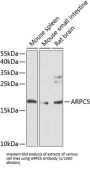 Actin Related Protein 2/3 Complex Subunit 5 (ARPC5) Antibody