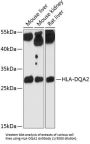 HLA Class II Histocompatibility Antigen, DQ Alpha 2 Chain (HLA-DQA2) Antibody