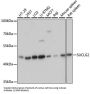Succinate-CoA Ligase GDP-Forming Beta Subunit (SUCLG2) Antibody