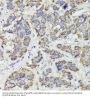 Succinate-CoA Ligase GDP-Forming Beta Subunit (SUCLG2) Antibody