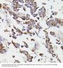 Succinate-CoA Ligase GDP-Forming Beta Subunit (SUCLG2) Antibody