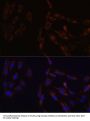 Succinate-CoA Ligase GDP-Forming Beta Subunit (SUCLG2) Antibody