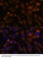 Succinate-CoA Ligase GDP-Forming Beta Subunit (SUCLG2) Antibody