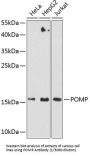 Proteasome Maturation Protein (POMP) Antibody