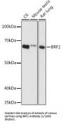 Transcription Factor IIIB 50 kDa Subunit (BRF2) Antibody