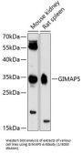GTPase IMAP Family Member 5 (GIMAP5) Antibody