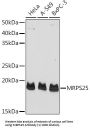 Mitochondrial Ribosomal Protein S25 (MRPS25) Antibody