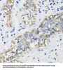 DEP Domain-Containing Protein 6 (DEPDC6) Antibody