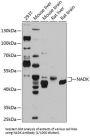 NAD Kinase (NADK) Antibody