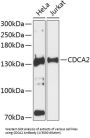 Cell Division Cycle Associated 2 (CDCA2) Antibody