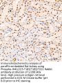 JNK1 / 2 / 3 p(T183 / T183 / T221) Antibody