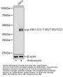 JNK1 / 2 / 3 p(T183 / T183 / T221) Antibody