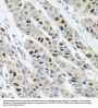 Proliferation Marker Protein Ki-67 (MKI67) Antibody