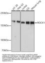 Rho-Associated Protein Kinase 1 (ROCK1) Antibody