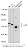 Alpha-1-B Glycoprotein (A1BG) Antibody