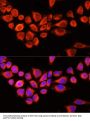 Arylacetamide Deacetylase (AADAC) Antibody