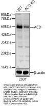 Adrenocortical Dysplasia Homolog (ACD) Antibody