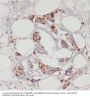 Acyl-CoA Synthetase Long-Chain Family Member 3 (ACSL3) Antibody