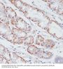 Acyl-CoA Synthetase Long-Chain Family Member 3 (ACSL3) Antibody