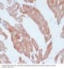 Acyl-CoA Synthetase Long-Chain Family Member 3 (ACSL3) Antibody