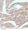 Acyl-CoA Synthetase Long-Chain Family Member 3 (ACSL3) Antibody