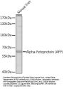 Alpha-Fetoprotein (AFP) Antibody