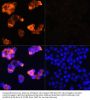 Alpha-Fetoprotein (AFP) Antibody