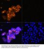 Alpha-Fetoprotein (AFP) Antibody