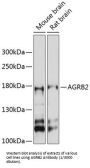 Adhesion G Protein-Coupled Receptor B2 (AGRB2) Antibody