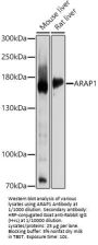 Arf-GAP With Rho-GAP Domain, ANK Repeat And PH Domain-Containing Protein 1 (ARAP1) Antibody