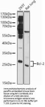 Apoptosis Regulator Bcl-2 (BCL2) Antibody