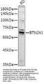 Butyrophilin Subfamily 2 Member A1 (BTN2A1) Antibody