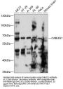 CDK5 And ABL1 Enzyme Substrate 1 (CABLES1) Antibody