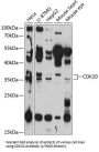 Cyclin Dependent Kinase 20 (CDK20) Antibody